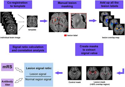 Brain Magnetic Resonance Imaging Characteristics of Anti-Leucine-Rich Glioma-Inactivated 1 Encephalitis and Their Clinical Relevance: A Single-Center Study in China